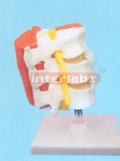 HUMAN LUMBAR VERTEBRAE WITH MUSCLES